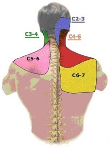 Cervical Facet Joint Syndrome | e-algos