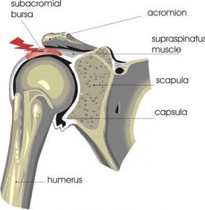 Interventional Techniques in the Shoulder | e-algos