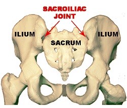 Sacroiliac joint injection